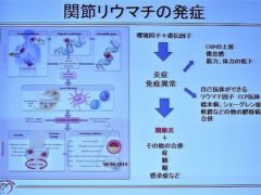 関節リウマチの発症